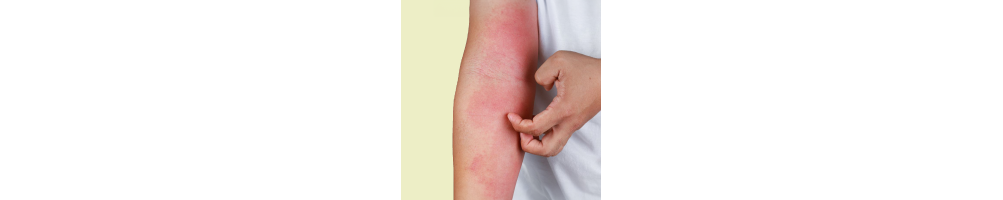 Cuidado para pieles con dematitis atópica