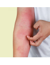 Cuidado para pieles con dematitis atópica